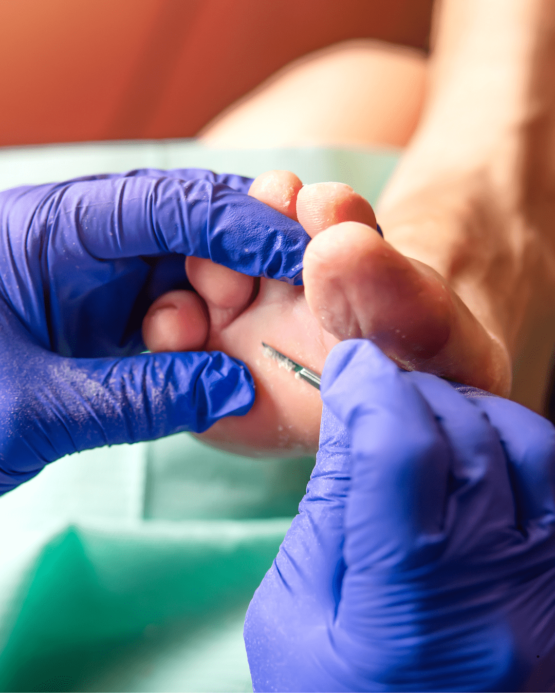 diabetic foot care and screening at kikis foot care clinic
