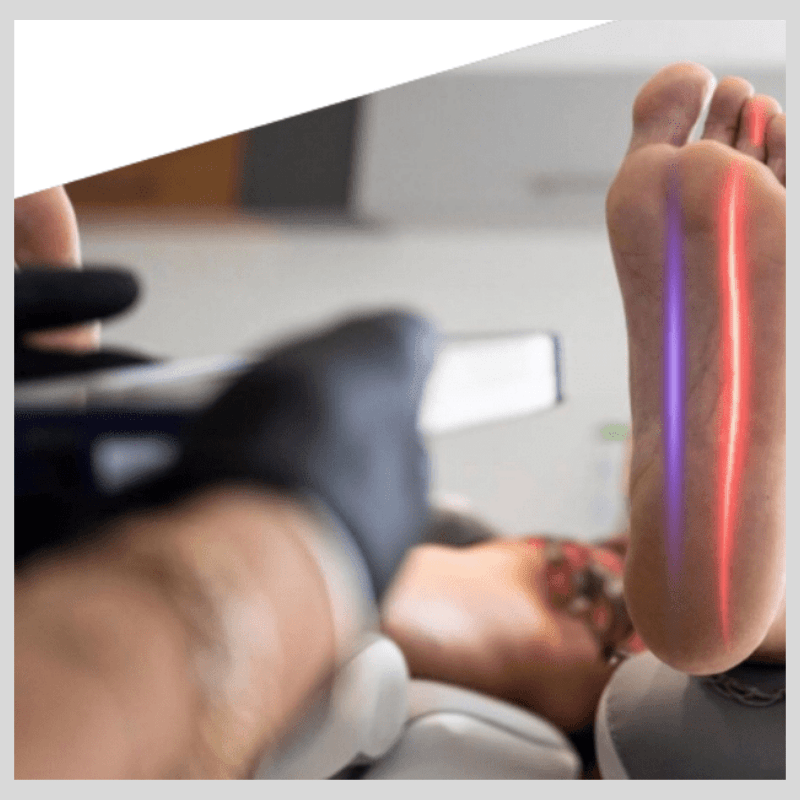 PAIN LASER FOR FOOT PAIN WOLVERHAMPTON PAIN LASER FOR FOOT PAIN WOLVERHAMPTON