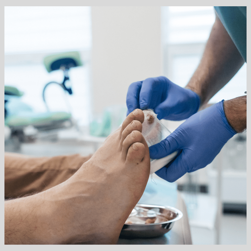 TOE NAIL SURGERY FOR INGROWN TOE NAILS WOLVERHAMPTON TOE-NAIL-SURGERY-FOR-INGROWN-TOE-NAILS-WOLVERHAMPTON