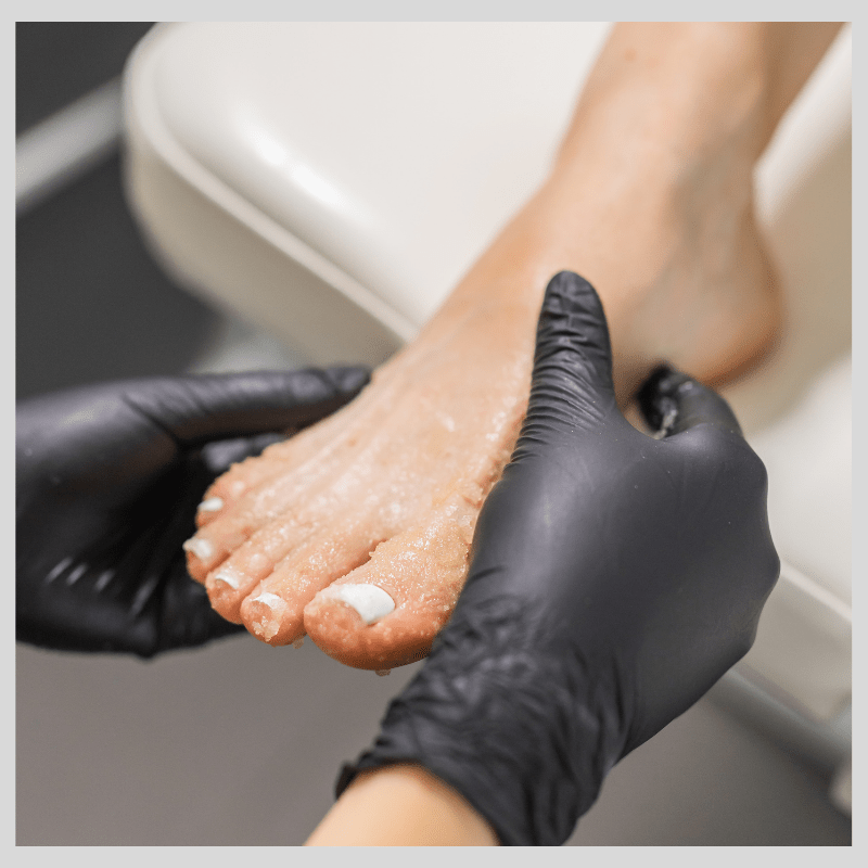 clinical medical pedicure WOLVERHAMPTON clinical medi pedi wolverhampton.
