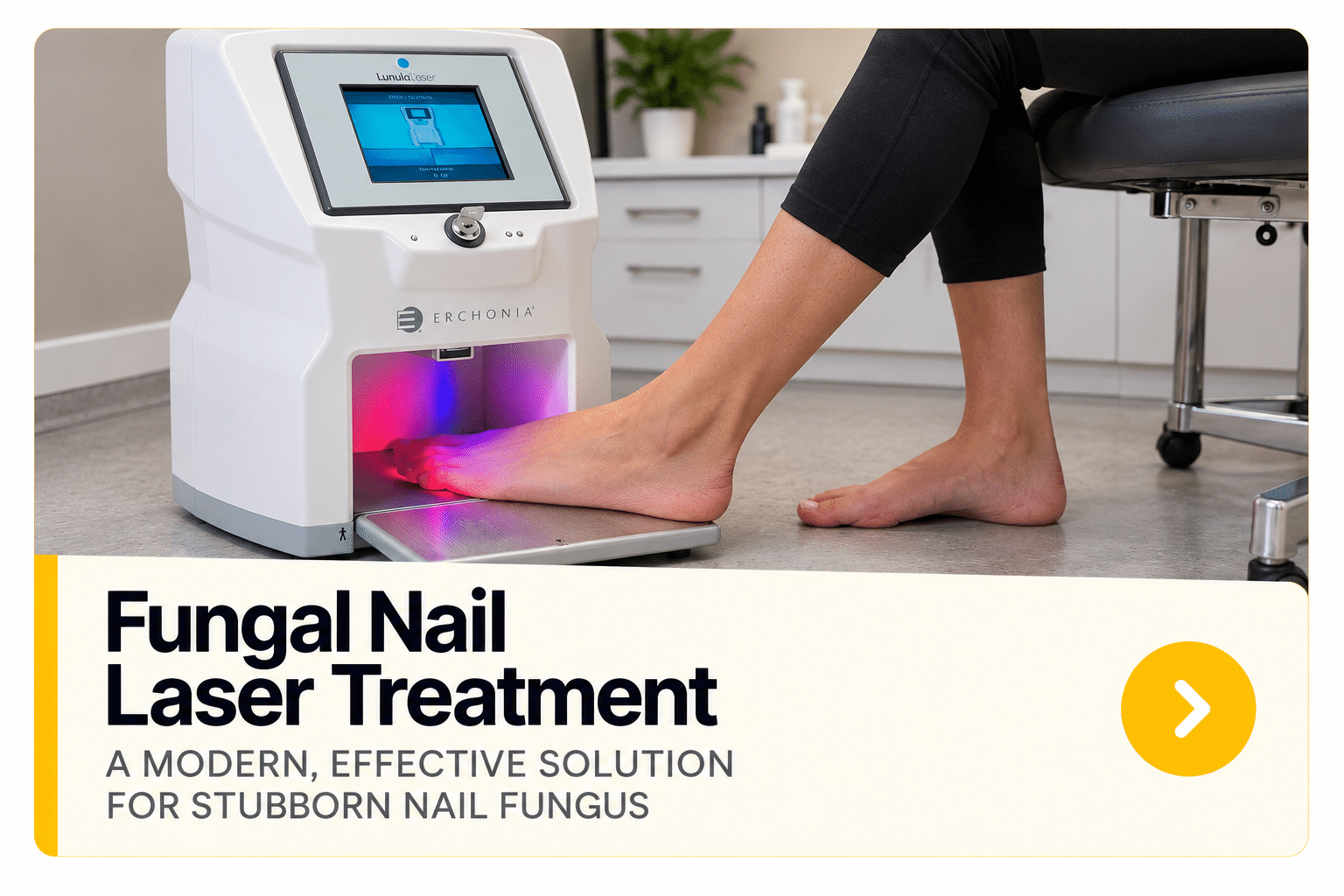 Fungal Nail Laser Treatment FUNGAL NAIL LASER CLINIC - KIKIS FOOT CARE CLINIC - WOLVERHAMPTON