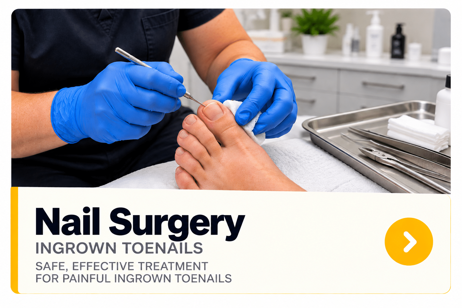 Ingrown Toenail Treatment Card toe nail surgery wolverhampton