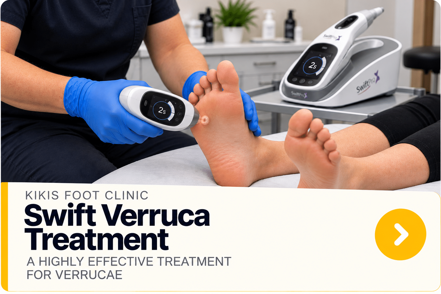 SwiftPro Verruca Treatment at Kikis Foot Clinic Kikis-Foot-Clinic-Swift-Verruca-Treatment wolverhampton